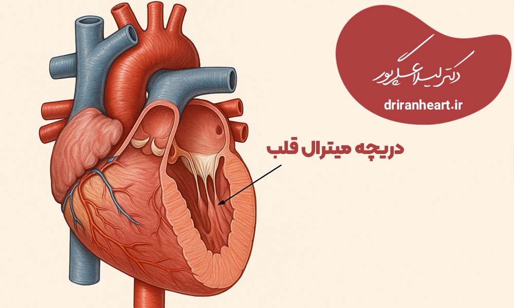 تعویض دریچه میترال قلب