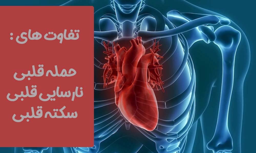 تفاوت حمله قلبی و سکته و نارسایی قلبی