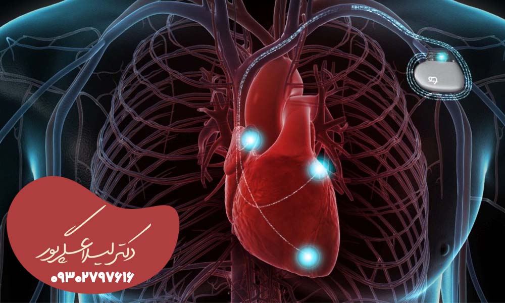 عمل باطری قلب کرج