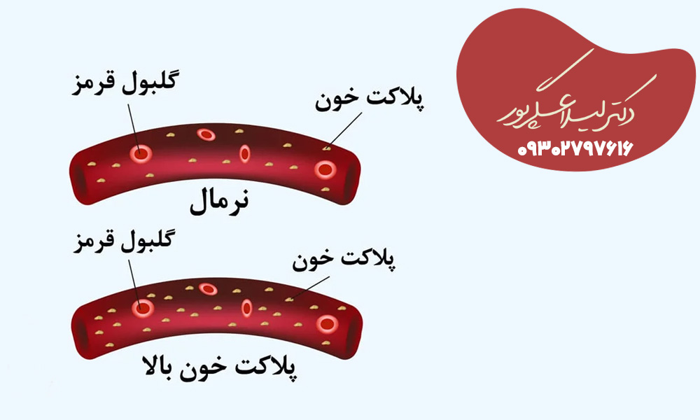 پلاکت خون بالا نشانه چیست