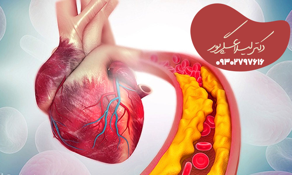 کاهش التهاب عروق